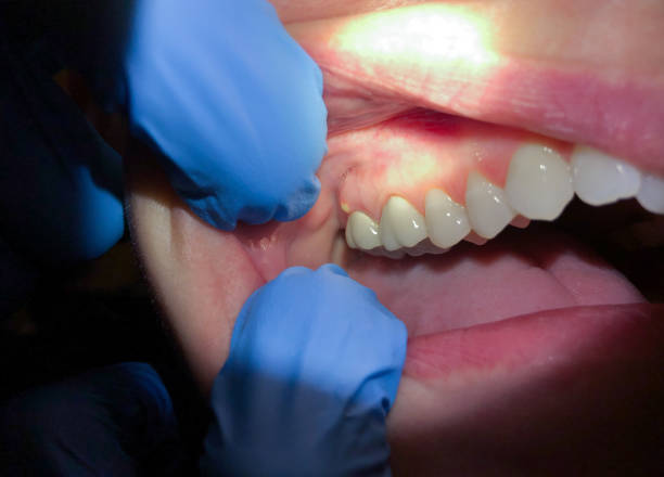  North St Paul, MN Emergency Dentist Pros